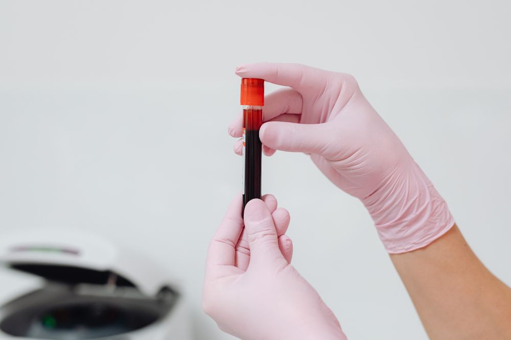 Teste pré-natal não invasivo