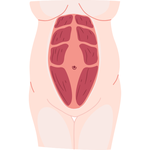 Diástase abdominal