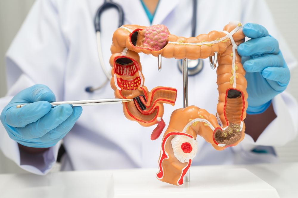 Gastrenterologista especialista em doença inflamatória intestinal no Porto